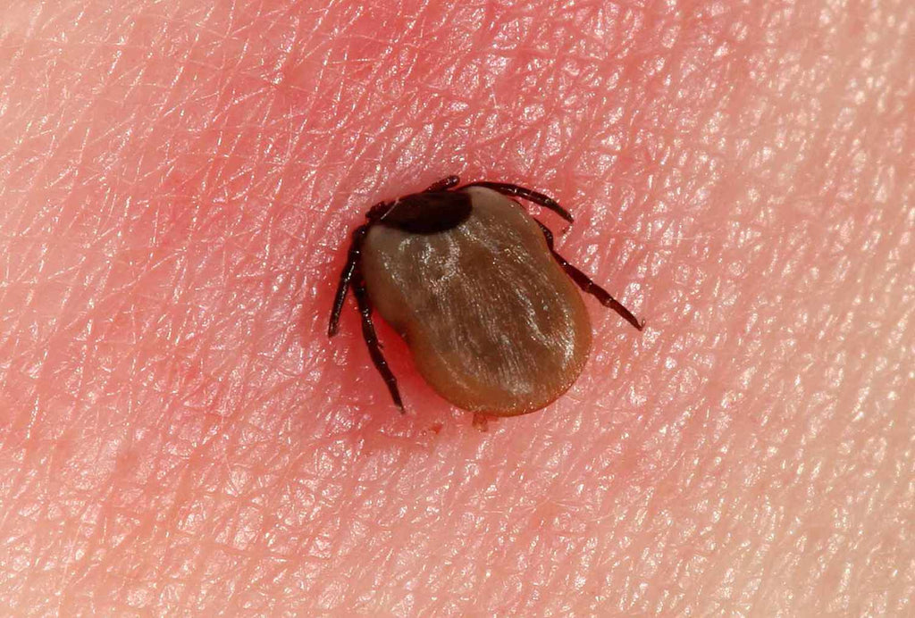 Tackling Tick Season: Staying Safe in the Great Outdoors